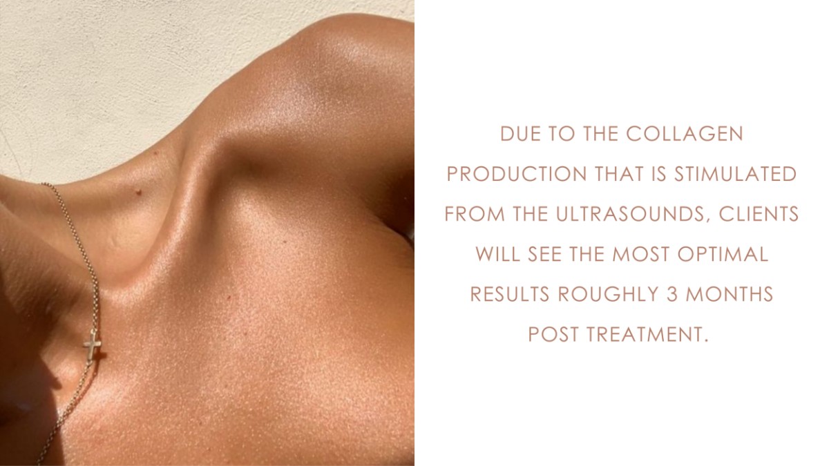 HIFU - Lift And Tighten Your Skin &bull; 16