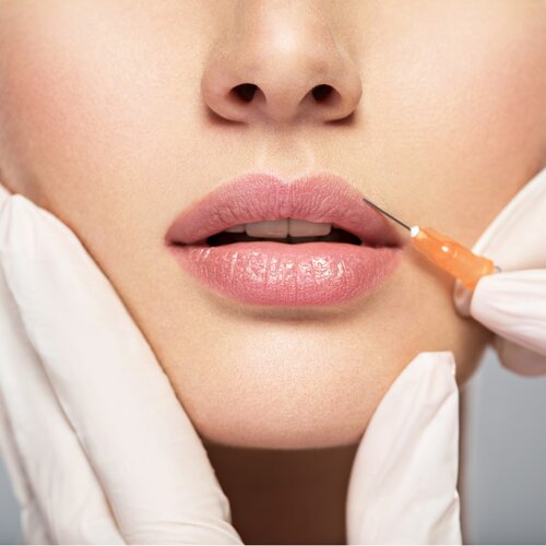 Dermal filler aftercare blog, model 01 GC Skin