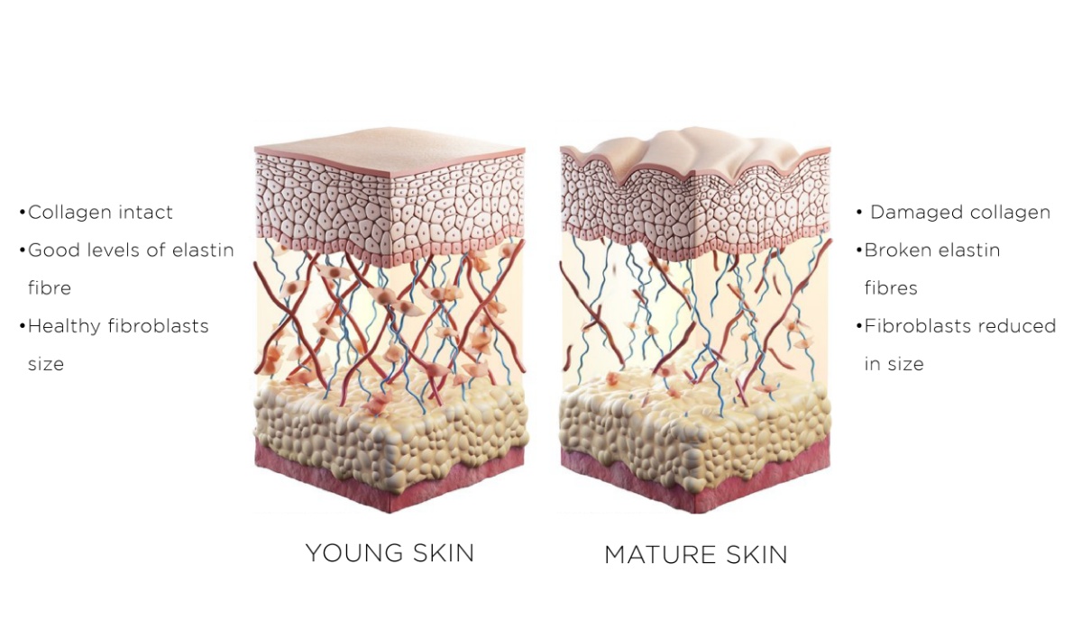 Winter Skin Wonders - Laser Therapy &bull; 3