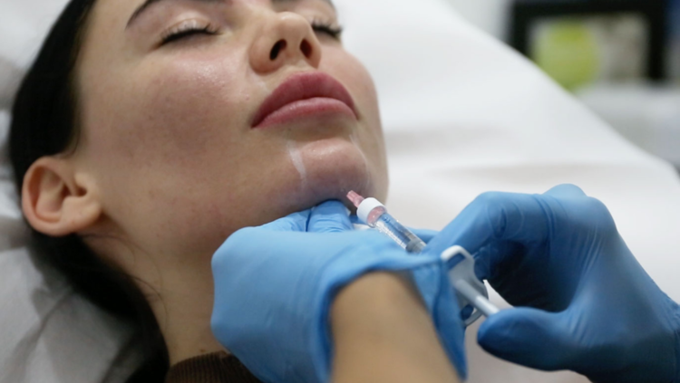 What We're Loving - Chin Filler &bull; 23