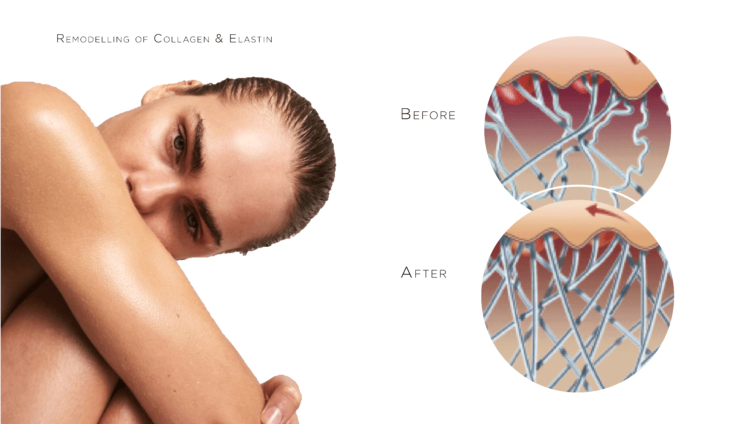 Bio-remodelling injections - the au naturel approach to skin health. 4 Build collagen and elastin