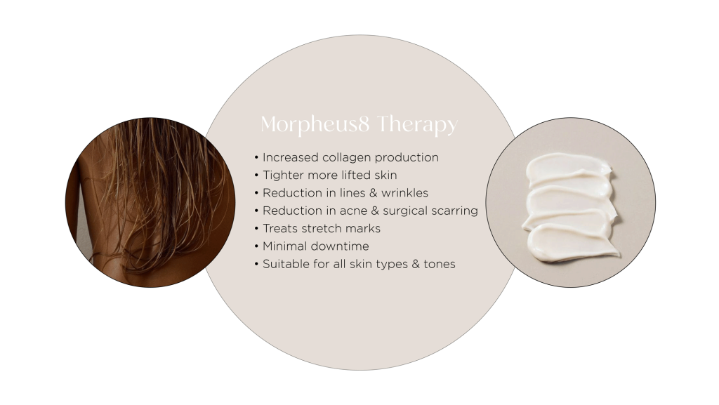 Surgical Scarring - try these 5 effective treatments! 4 Morpheus8 Therapy