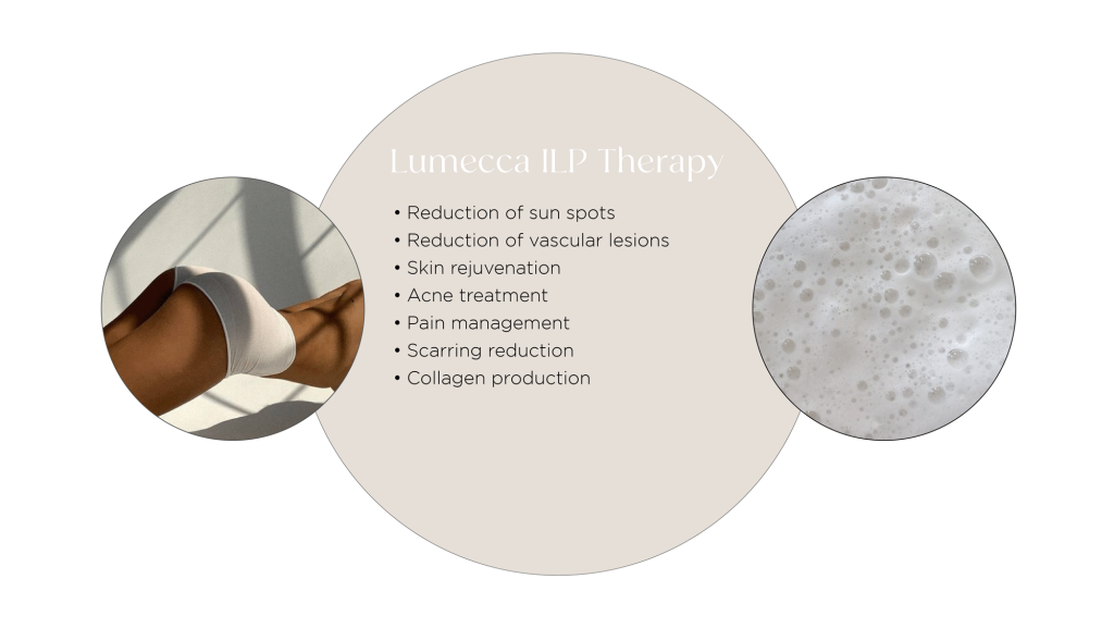 Surgical Scarring - try these 5 effective treatments! 3 Lumecca IPL Treatment