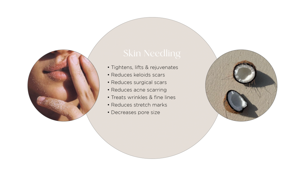 Surgical Scarring - try these 5 effective treatments! 6 Skin needling for scarring