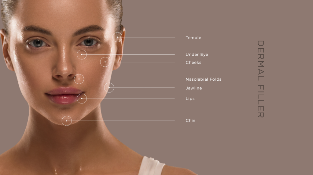 Kick off your hot girl summer with injectables! 6 Dermal Fillers - what they treat