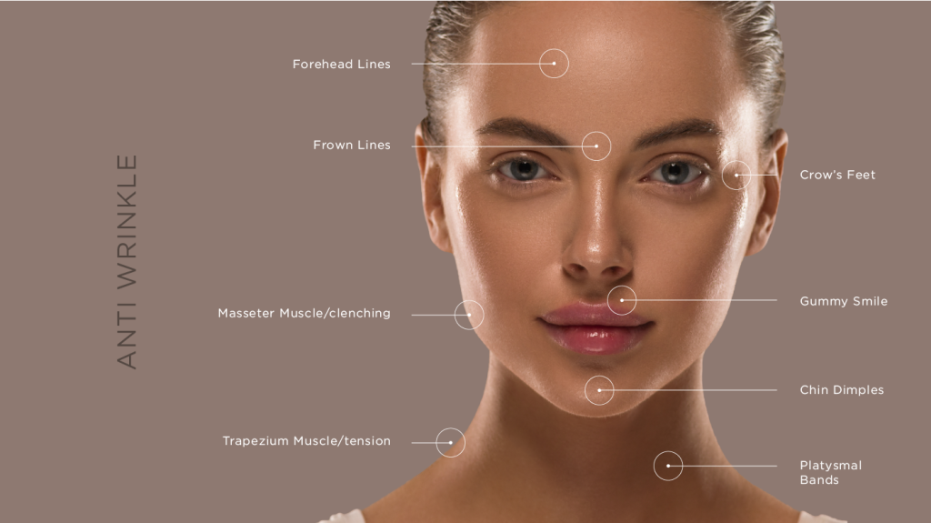 Kick off your hot girl summer with injectables! 4 Anti-wrinkle injections
