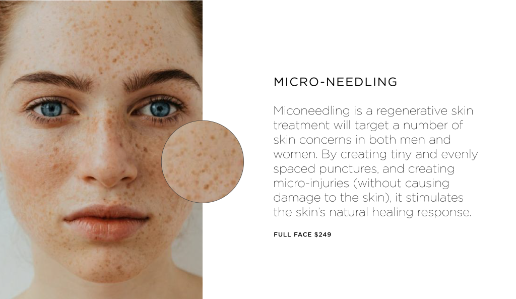 PSA: pigment can be corrected 7 Pigment can be corrected with Micro-needling
