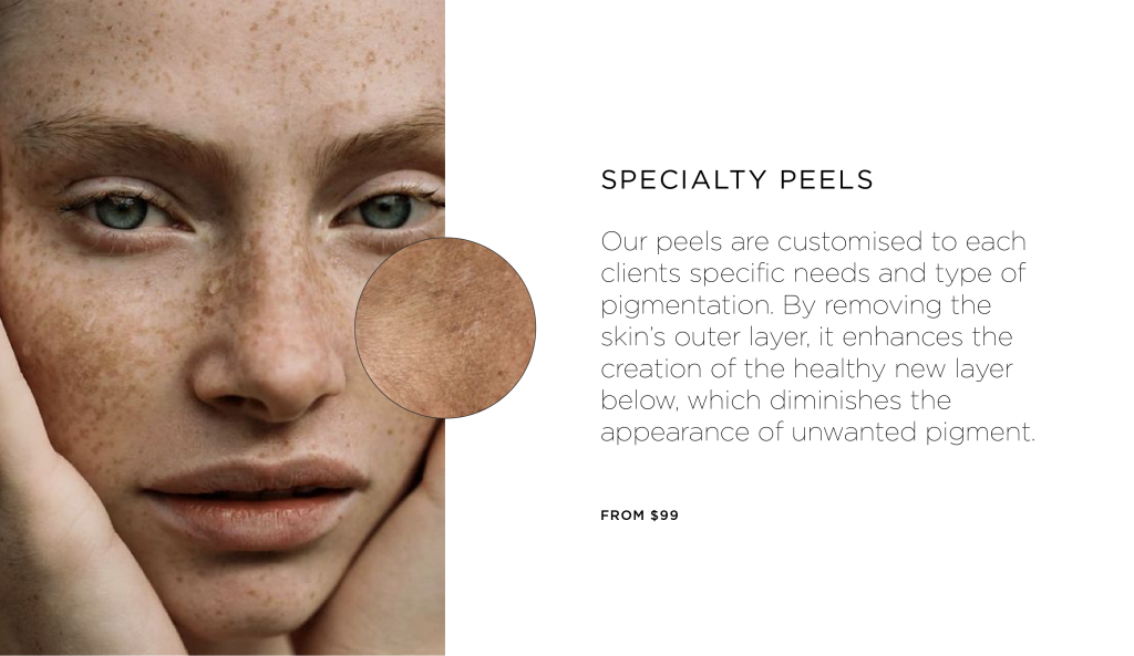 PSA: pigment can be corrected 6 Pigment can be corrected with Specialty Peels